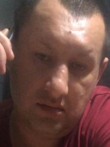 кат ізоляція